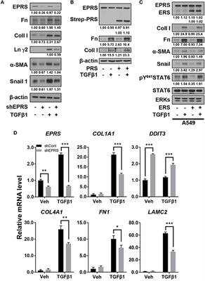 Glutamyl-Prolyl-tRNA Synthetase Regulates Epithelial Expression of Mesenchymal Markers and Extracellular Matrix Proteins: Implications for Idiopathic Pulmonary Fibrosis